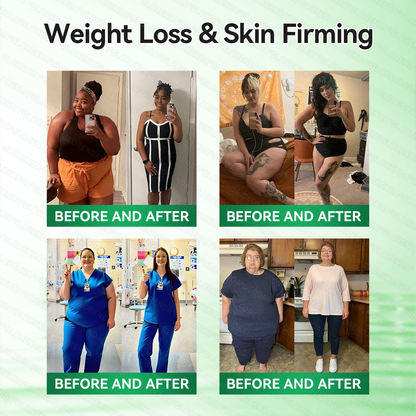 𝑶𝒇𝒇𝒊𝒄𝒊𝒂𝒍 𝑺𝒕𝒐𝒓𝒆  | 👩‍⚕️𝐆𝐋𝐎𝑹𝑬𝑵𝑫𝗔®𝑴𝒐𝒓𝒊𝒏𝒈𝗮 · 𝗕𝗲𝗿𝗯𝗲𝗿𝙞𝙣𝙚 × 𝙉𝘼𝐃+ 𝟏𝟎-𝐢𝐧-𝟏 𝗔𝗱𝘃𝗮𝗻𝗰𝙚𝙙 𝙉𝙖𝙣𝙤 𝙈𝙞𝙘𝙧𝙤𝙣𝙚𝙚𝐝𝐥𝐞 𝐏𝐚𝐭𝙘𝙝🇺🇸(𝐉𝐮𝐬𝐭 𝐨𝐧𝐜𝐞 𝐚 𝐝𝐚𝐲, 𝐯𝐢𝐬𝐢𝐛𝐥𝐞 𝐜𝐡𝐚𝐧𝐠𝐞𝐬 𝐢𝐧 𝟕 𝐝𝐚𝐲𝐬） ✅ 𝐅𝐨𝐫 𝐨𝐛𝐞𝐬𝐢𝐭𝐲, 🅛🅞🅞🅢🅔 🅢🅚🅘🅝,𝐝𝐢𝐚𝐛𝐞𝐭𝐞𝐬, 𝐬𝐥𝐞𝐞𝐩 𝐚𝐩𝐧𝐞𝐚, 𝐣𝐨𝐢𝐧𝐭 𝐢𝐬𝐬𝐮𝐞𝐬, 𝐚𝐧𝐝 𝐦𝐨𝐫𝐞