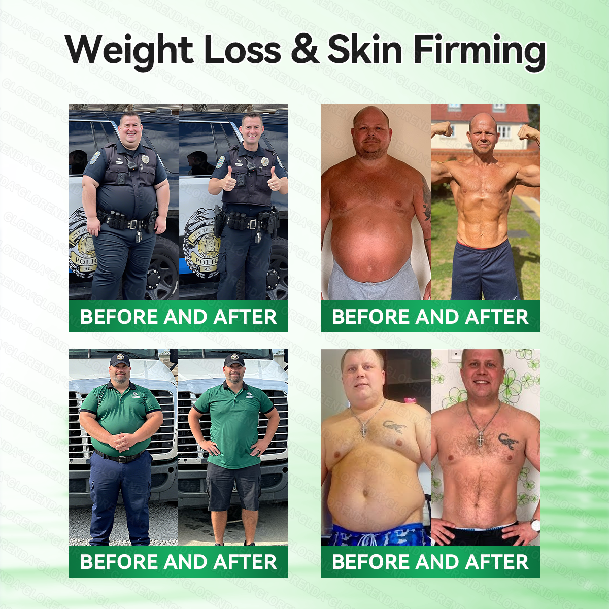 𝑶𝒇𝒇𝒊𝒄𝒊𝒂𝒍 𝑺𝒕𝒐𝒓𝒆  | 👩‍⚕️𝐆𝐋𝐎𝑹𝑬𝑵𝑫𝗔®𝑴𝒐𝒓𝒊𝒏𝒈𝗮 · 𝗕𝗲𝗿𝗯𝗲𝗿𝙞𝙣𝙚 × 𝙉𝘼𝐃+ 𝟏𝟎-𝐢𝐧-𝟏 𝗔𝗱𝘃𝗮𝗻𝗰𝙚𝙙 𝙉𝙖𝙣𝙤 𝙈𝙞𝙘𝙧𝙤𝙣𝙚𝙚𝐝𝐥𝐞 𝐏𝐚𝐭𝙘𝙝🇺🇸(𝐉𝐮𝐬𝐭 𝐨𝐧𝐜𝐞 𝐚 𝐝𝐚𝐲, 𝐯𝐢𝐬𝐢𝐛𝐥𝐞 𝐜𝐡𝐚𝐧𝐠𝐞𝐬 𝐢𝐧 𝟕 𝐝𝐚𝐲𝐬） ✅ 𝐅𝐨𝐫 𝐨𝐛𝐞𝐬𝐢𝐭𝐲, 🅛🅞🅞🅢🅔 🅢🅚🅘🅝,𝐝𝐢𝐚𝐛𝐞𝐭𝐞𝐬, 𝐬𝐥𝐞𝐞𝐩 𝐚𝐩𝐧𝐞𝐚, 𝐣𝐨𝐢𝐧𝐭 𝐢𝐬𝐬𝐮𝐞𝐬, 𝐚𝐧𝐝 𝐦𝐨𝐫𝐞